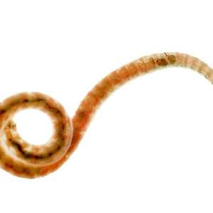 Oligochaeta (Aquatic Freshwater Worm)